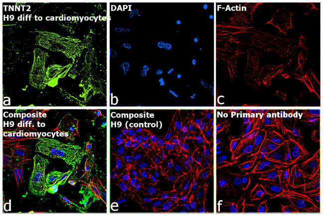 Cardiac Troponin T Antibody in Immunocytochemistry (ICC/IF)