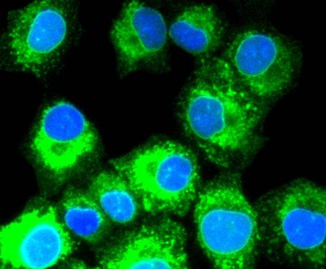 SHH Antibody in Immunocytochemistry (ICC/IF)