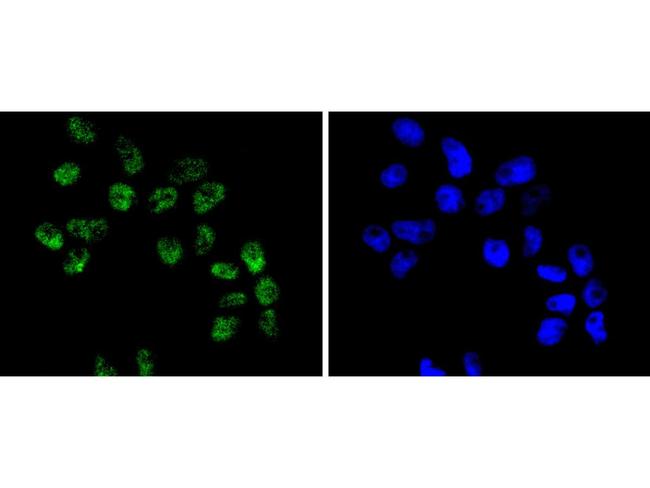 BRG1 Antibody in Immunocytochemistry (ICC/IF)