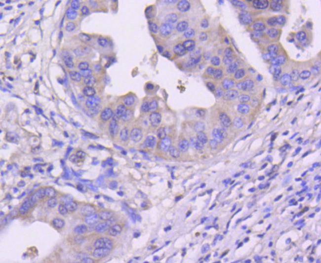 CDK4 Antibody in Immunohistochemistry (Paraffin) (IHC (P))