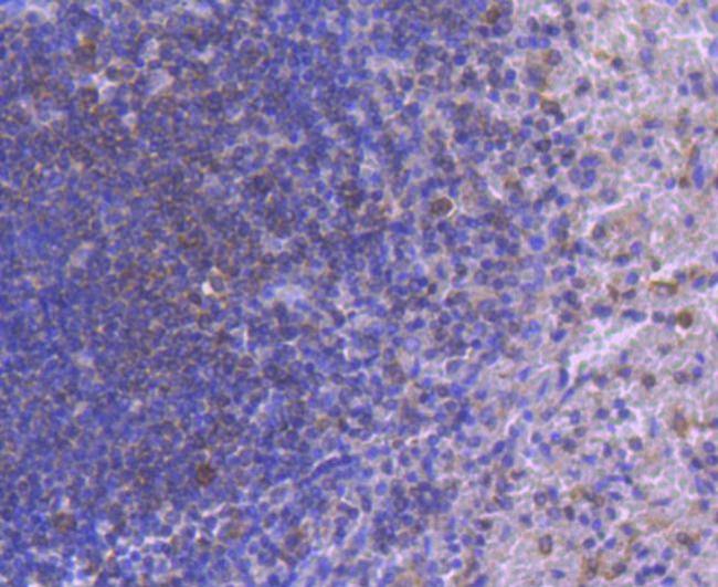 IRF5 Antibody in Immunohistochemistry (Paraffin) (IHC (P))