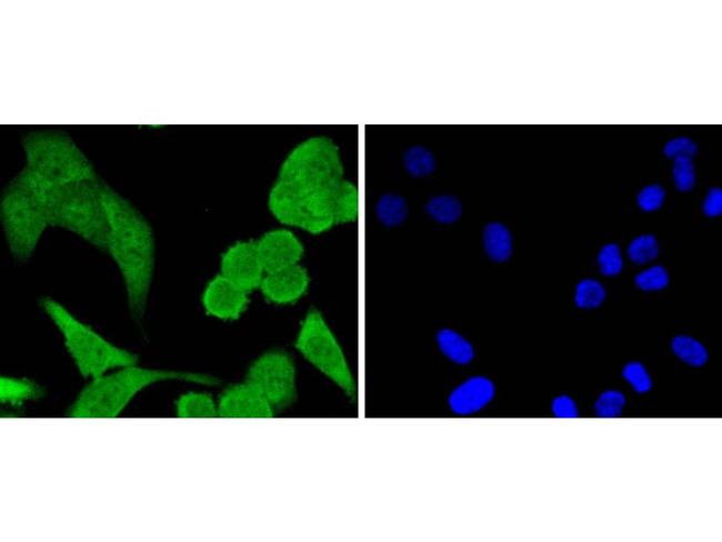 STAT1 Antibody in Immunocytochemistry (ICC/IF)