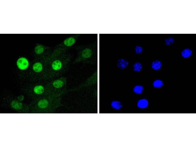 CDK4 Antibody in Immunocytochemistry (ICC/IF)