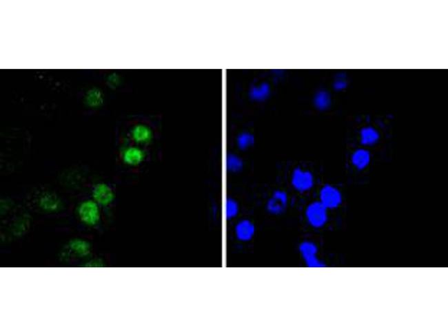 RUNX2 Antibody in Immunocytochemistry (ICC/IF)