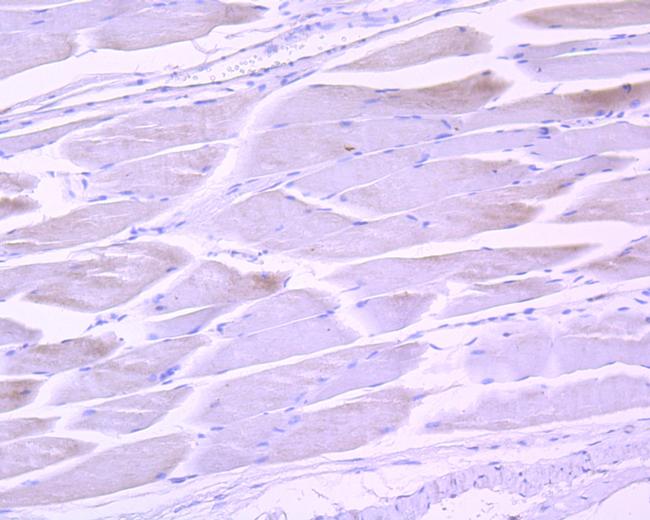 Phospho-STAT3 (Tyr705) Antibody in Immunohistochemistry (Paraffin) (IHC (P))