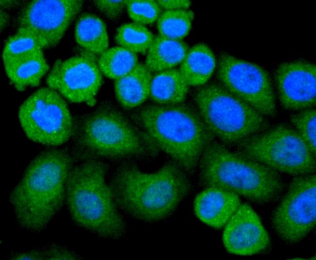 GPX1 Antibody in Immunocytochemistry (ICC/IF)