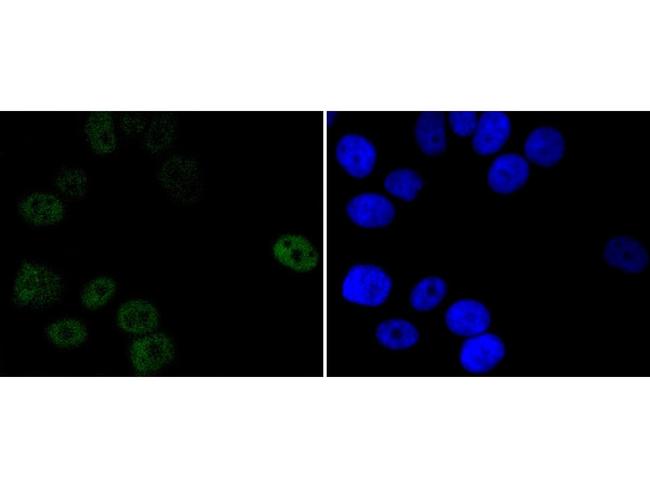 Progesterone Receptor Antibody in Immunocytochemistry (ICC/IF)