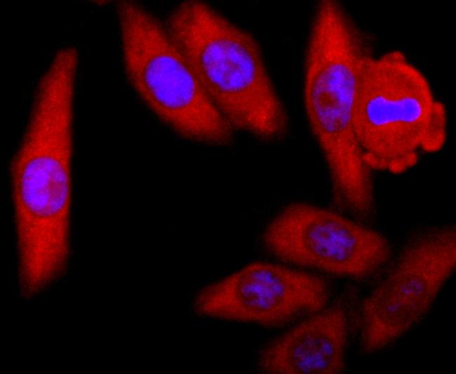 SOD1 Antibody in Immunocytochemistry (ICC/IF)