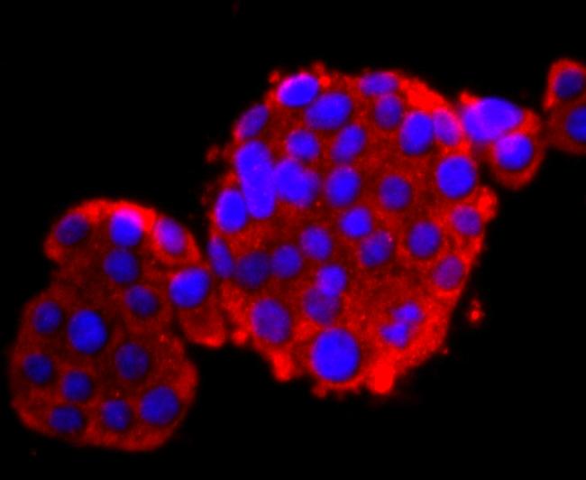 Calbindin D28K Antibody in Immunocytochemistry (ICC/IF)