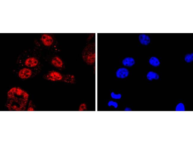 KLF4 Antibody in Immunocytochemistry (ICC/IF)