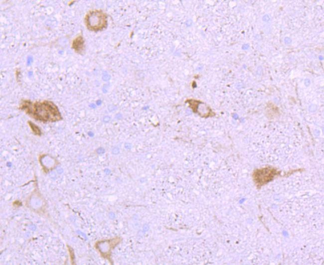 NF-H Antibody in Immunohistochemistry (Paraffin) (IHC (P))