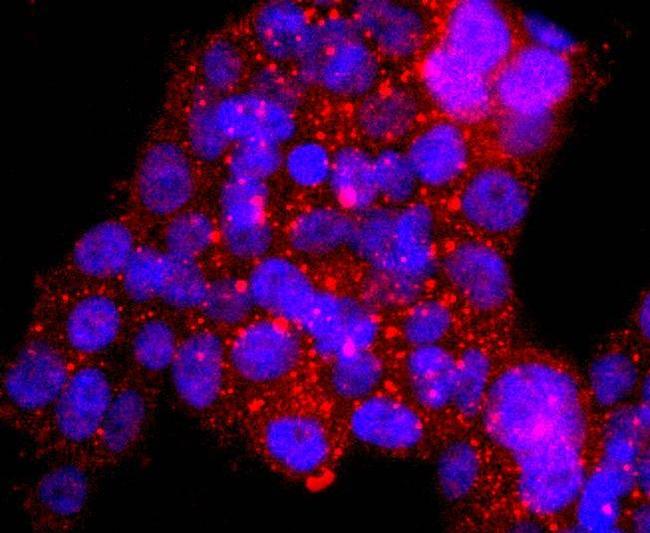 53BP2 Antibody in Immunocytochemistry (ICC/IF)