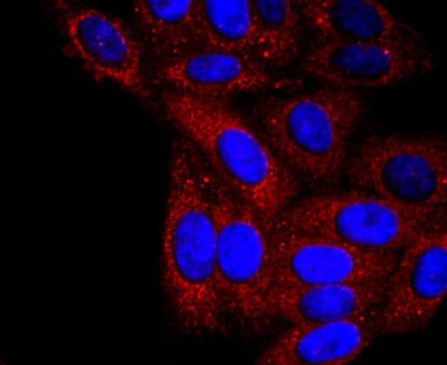 alpha-1 Antitrypsin Antibody in Immunocytochemistry (ICC/IF)