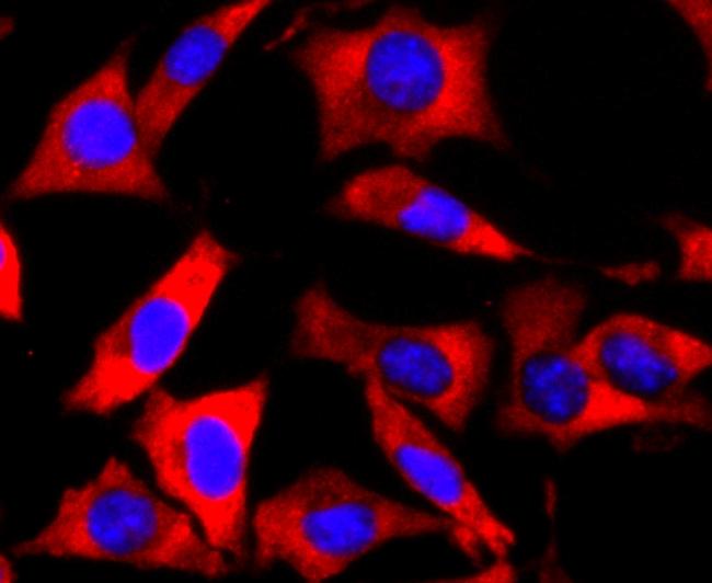 FMRP Antibody in Immunocytochemistry (ICC/IF)