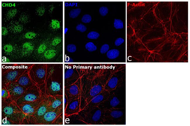 CHD4 Antibody in Immunocytochemistry (ICC/IF)