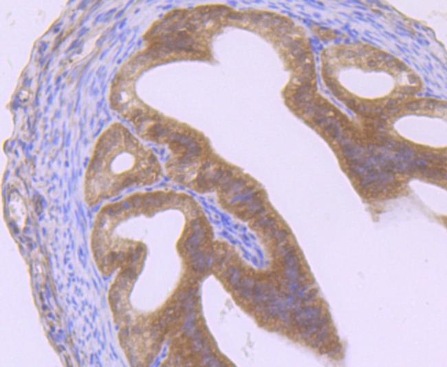 GIT1 Antibody in Immunohistochemistry (Paraffin) (IHC (P))