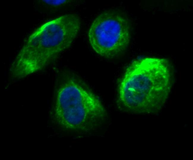 Securin Antibody in Immunocytochemistry (ICC/IF)