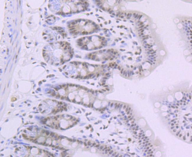 SMARCB1 Antibody in Immunohistochemistry (Paraffin) (IHC (P))