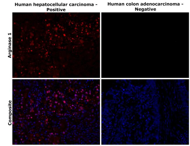 Arginase 1 Antibody in Immunohistochemistry (Paraffin) (IHC (P))