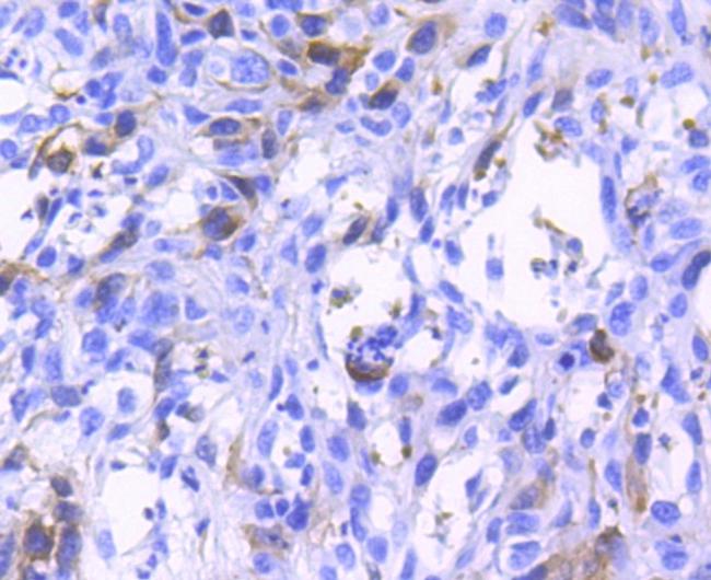 Phospho-CDK2 (Tyr15) Antibody in Immunohistochemistry (Paraffin) (IHC (P))