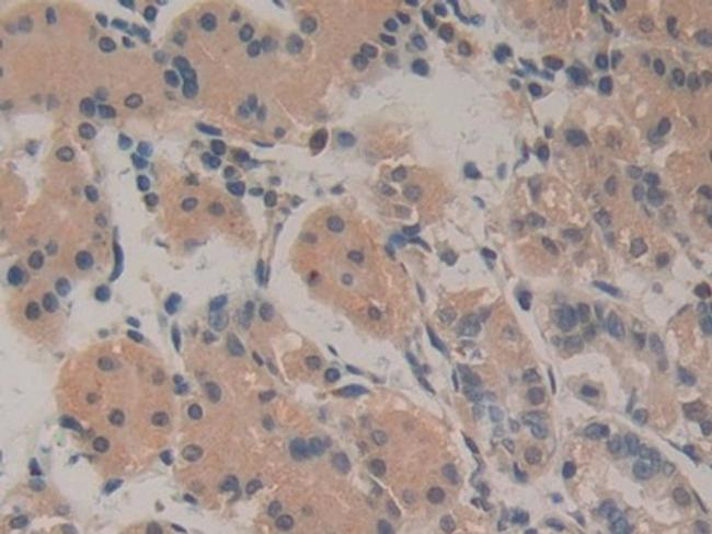 Amphiregulin Antibody in Immunohistochemistry (Paraffin) (IHC (P))