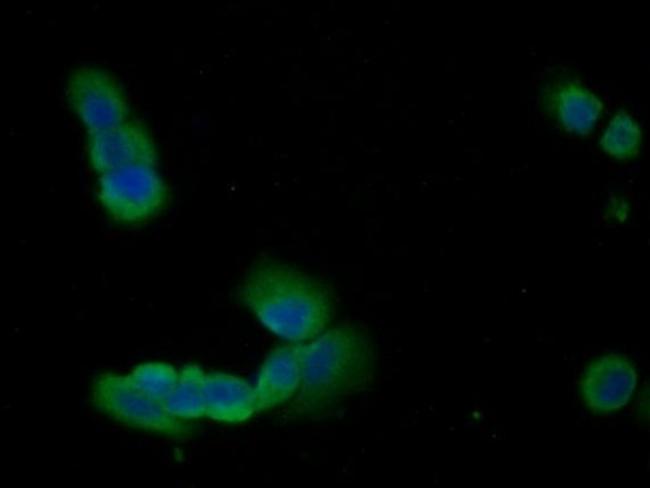 Annexin A1 Antibody in Immunocytochemistry (ICC/IF)