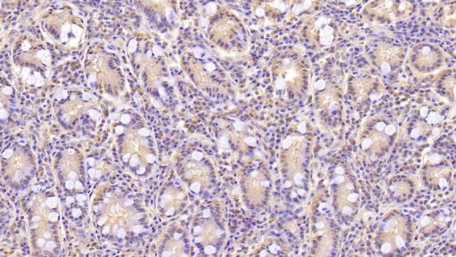 Annexin V Antibody in Immunohistochemistry (Paraffin) (IHC (P))