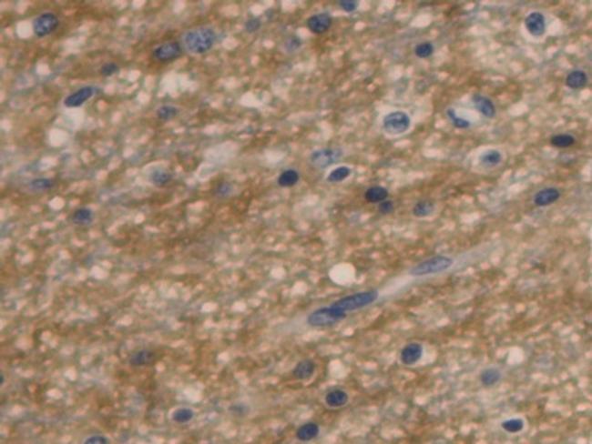 Aquaporin 4 Antibody in Immunohistochemistry (Paraffin) (IHC (P))