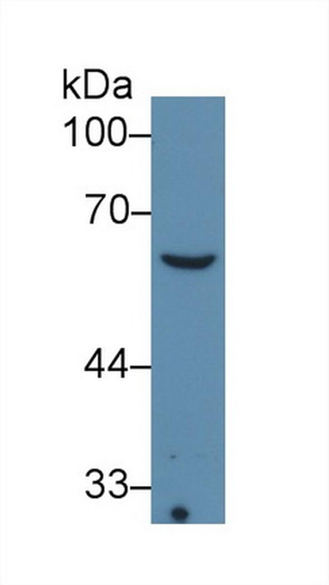 COL8A1 Antibody in Western Blot (WB)