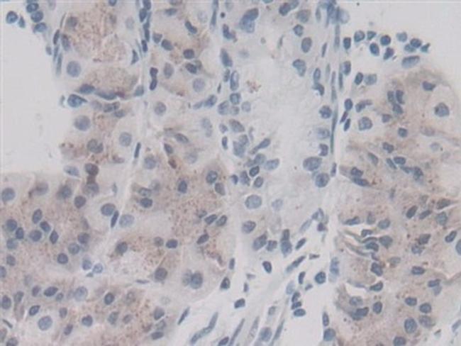 Cyclophilin A Antibody in Immunohistochemistry (Paraffin) (IHC (P))