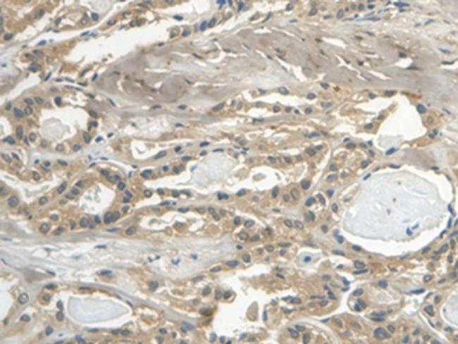 Cystatin C Antibody in Immunohistochemistry (Paraffin) (IHC (P))