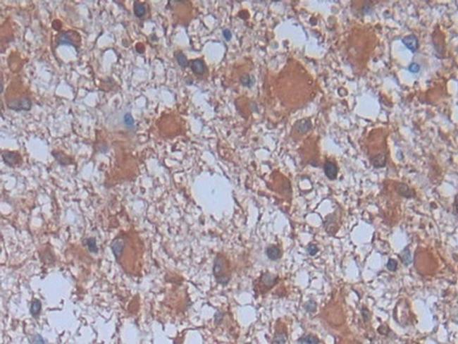 PLA2G4A Antibody in Immunohistochemistry (Paraffin) (IHC (P))