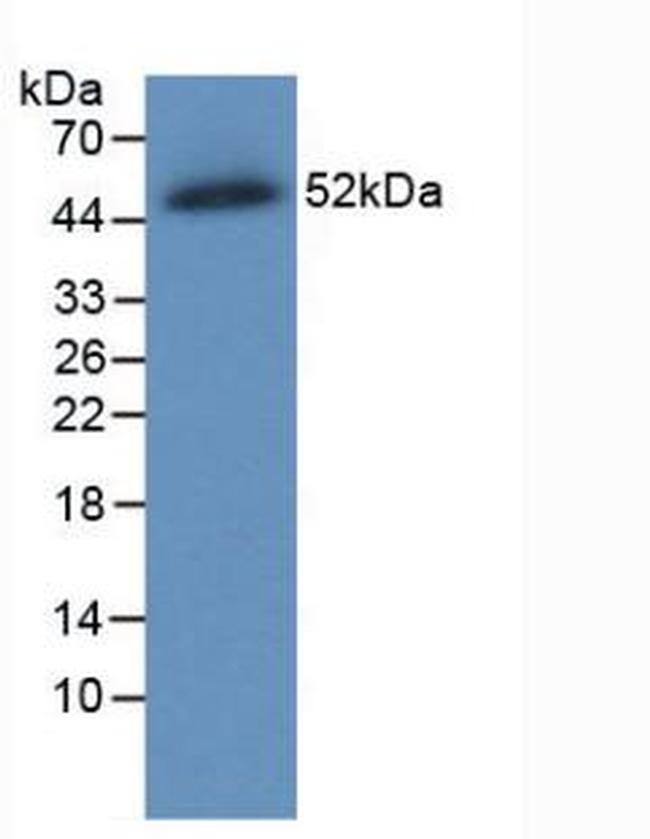 Ferroportin Antibody in Western Blot (WB)