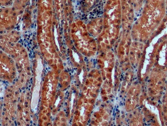 alpha Galactosidase Antibody in Immunohistochemistry (Paraffin) (IHC (P))