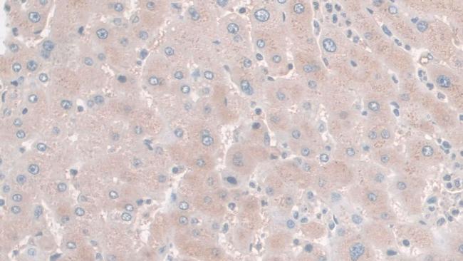 HPR Antibody in Immunohistochemistry (Paraffin) (IHC (P))