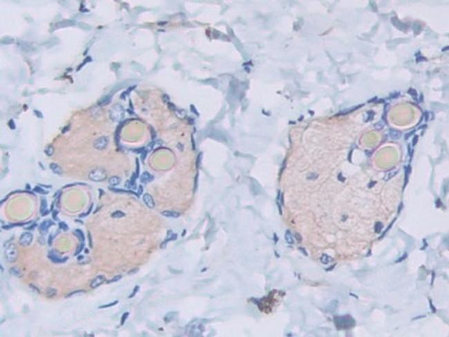 HSP20 Antibody in Immunohistochemistry (Paraffin) (IHC (P))