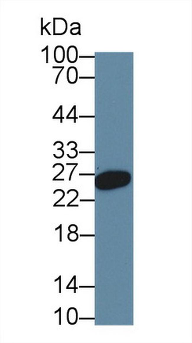 HFE2 Antibody in Western Blot (WB)