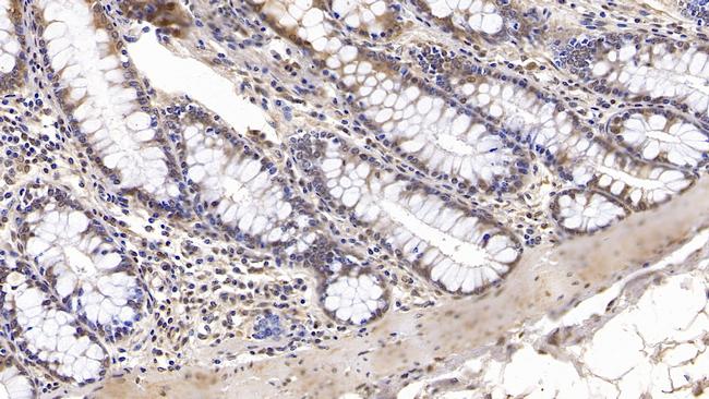 IGFBP4 Antibody in Immunohistochemistry (Paraffin) (IHC (P))