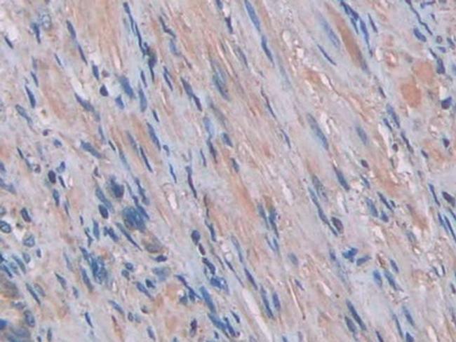 IL-1 alpha Antibody in Immunohistochemistry (Paraffin) (IHC (P))