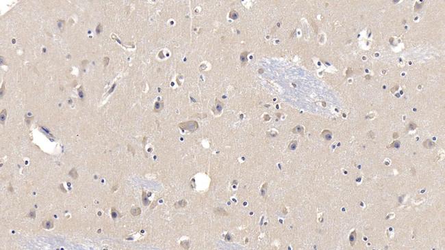 LCAT Antibody in Immunohistochemistry (Paraffin) (IHC (P))