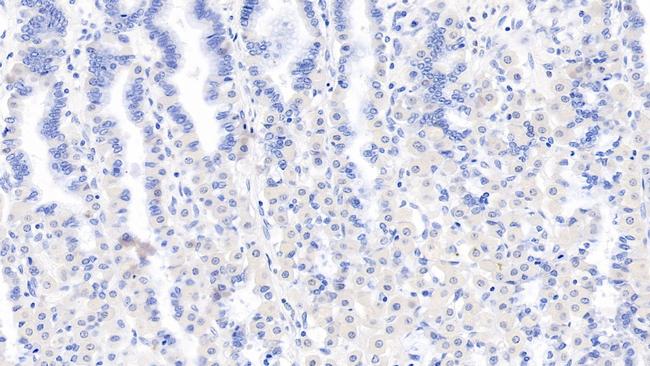 LSR Antibody in Immunohistochemistry (Paraffin) (IHC (P))