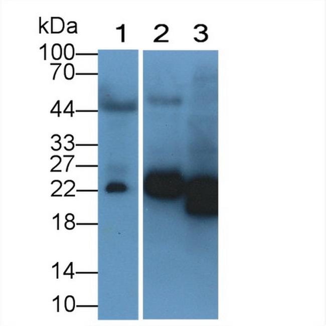 NGAL Antibody in Western Blot (WB)