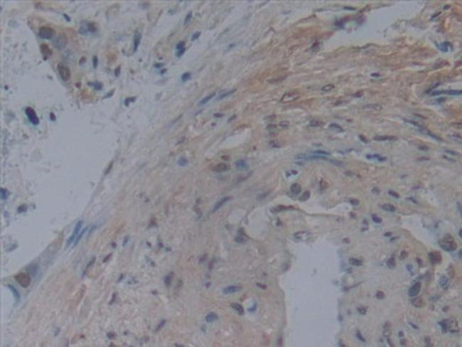 Noggin Antibody in Immunohistochemistry (Paraffin) (IHC (P))