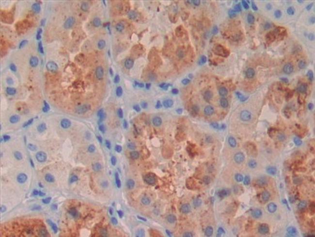 RBP4 Antibody in Immunohistochemistry (Paraffin) (IHC (P))