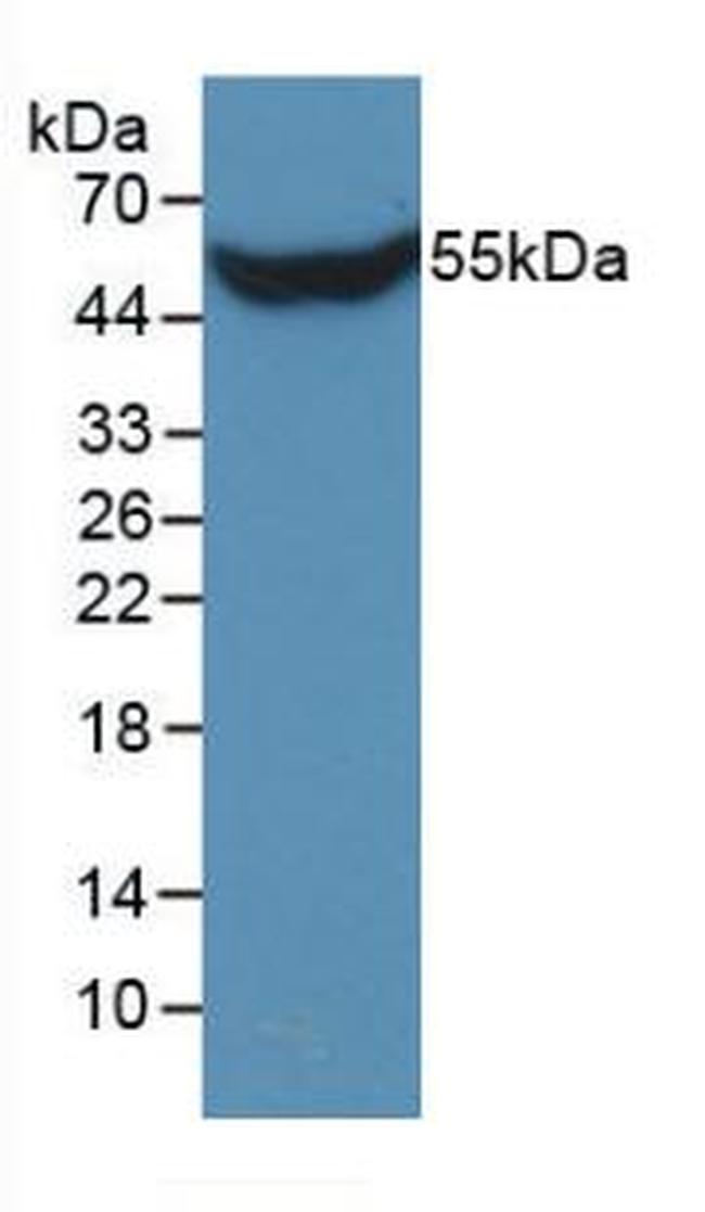 STC1 Antibody in Western Blot (WB)