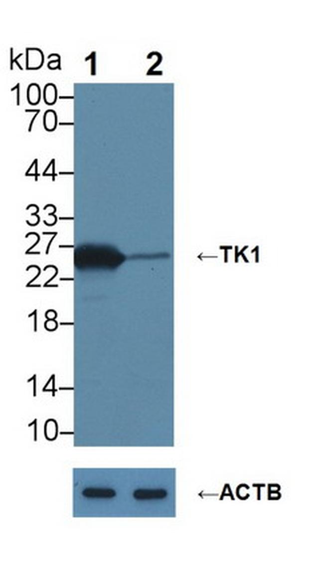 TK1 Antibody in Western Blot (WB)