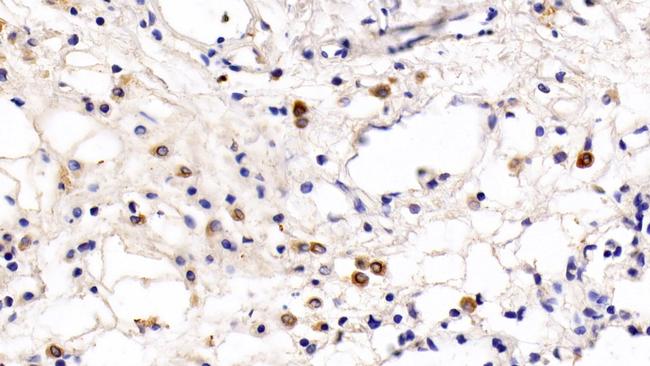 TLR5 Antibody in Immunohistochemistry (Paraffin) (IHC (P))