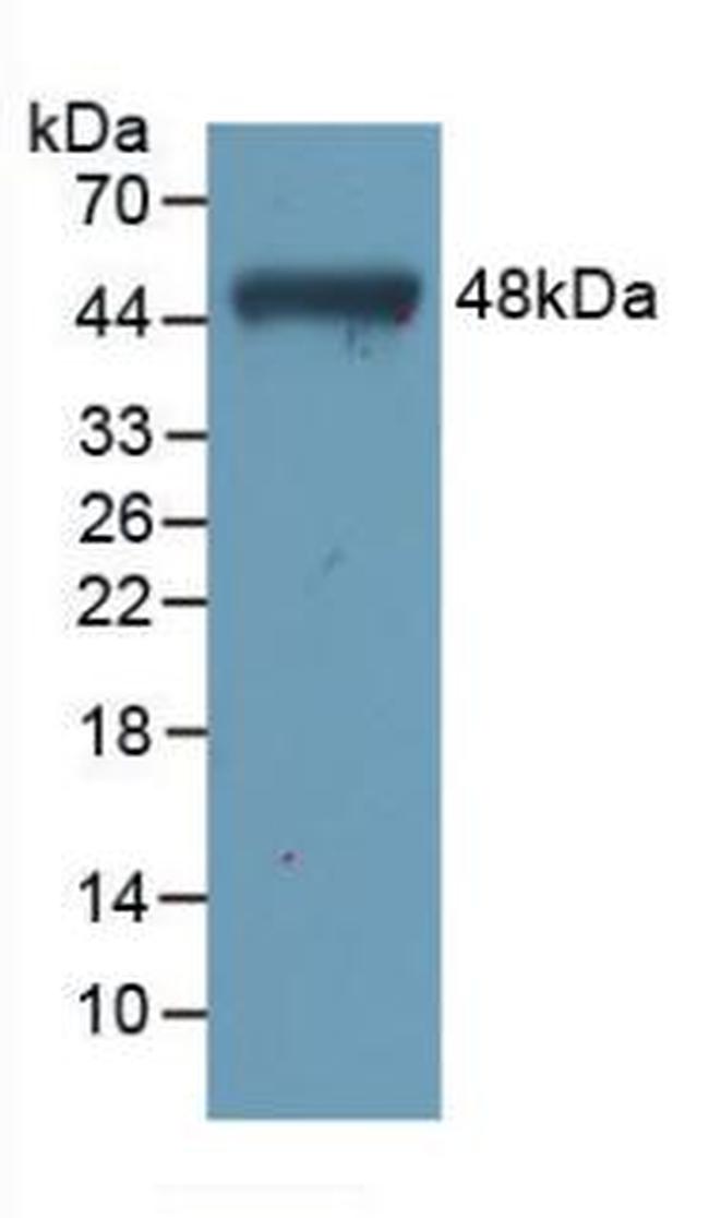 Cardiac Troponin I Antibody in Western Blot (WB)