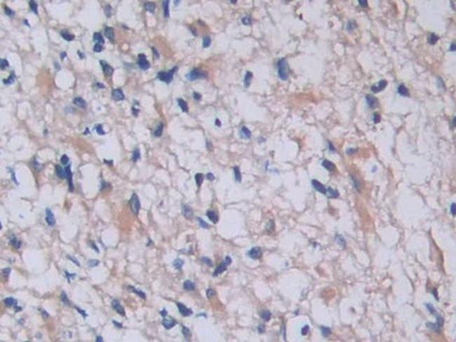 Tryptase Antibody in Immunohistochemistry (Paraffin) (IHC (P))