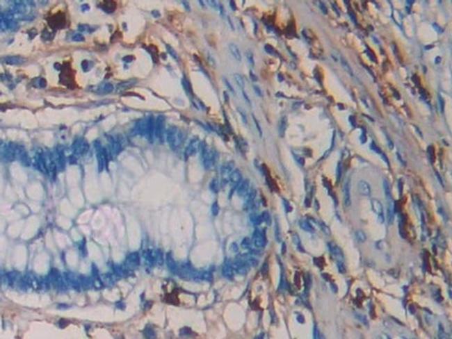 Tryptase Antibody in Immunohistochemistry (Paraffin) (IHC (P))